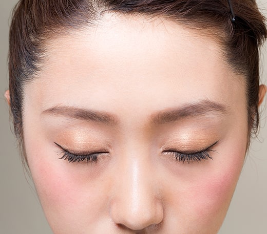 Treatments-Injectables-Dysport Treatments Injectables Dysport