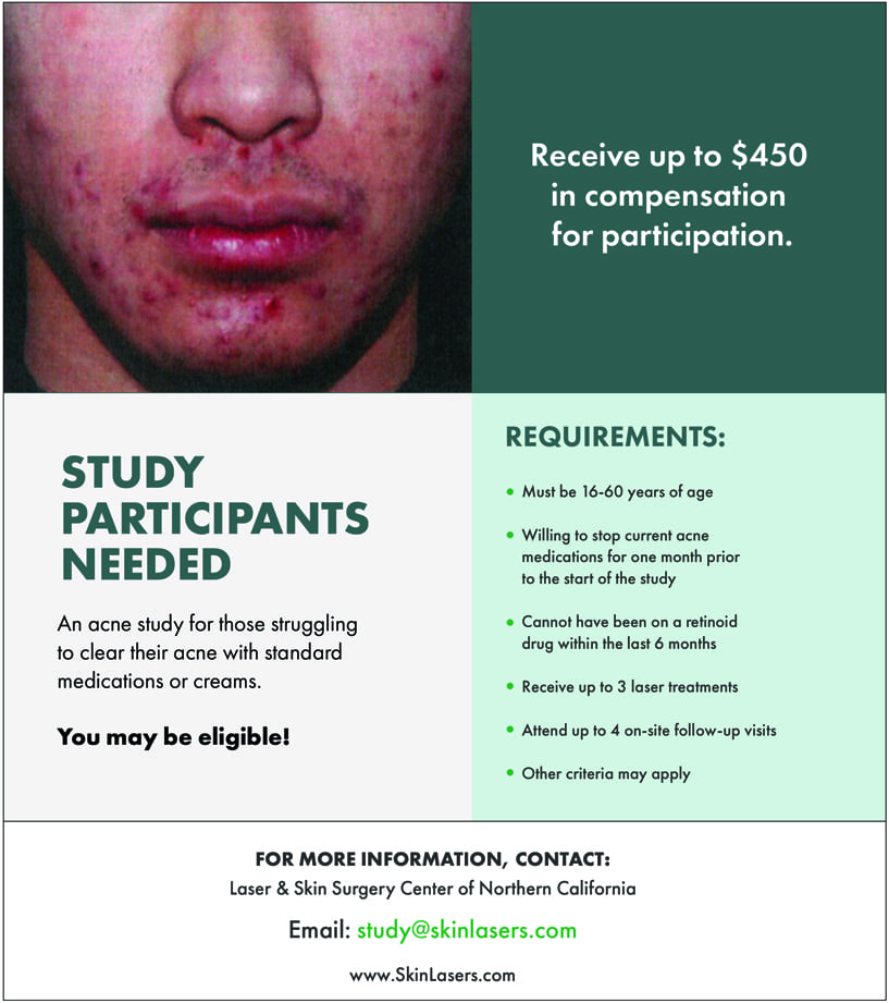 L&S Acne Study Participants Needed L&S Acne Study Participants Needed