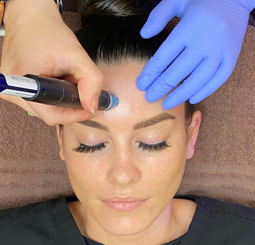 What is HydraFacial