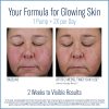 Skinbetter Mystro Active Balance Serum - Image 2