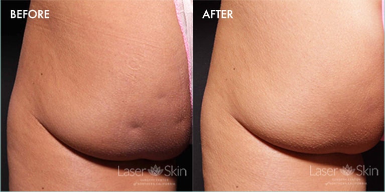 before-after-1-1.jpg