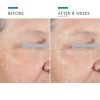 SkinCeuticals A.G.E. Advanced Eye - Image 7