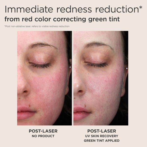 Elta UV Skin Recovery Broad Spectrum SPF 50 Red Color Correcting Face Sunscreen - Image 7