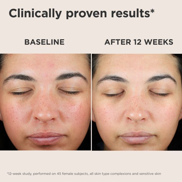 Elta UV Skin Recovery Broad Spectrum SPF 50 Red Color Correcting Face Sunscreen - Image 6