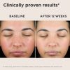 Elta UV Skin Recovery Broad Spectrum SPF 50 Face Sunscreen - Image 6
