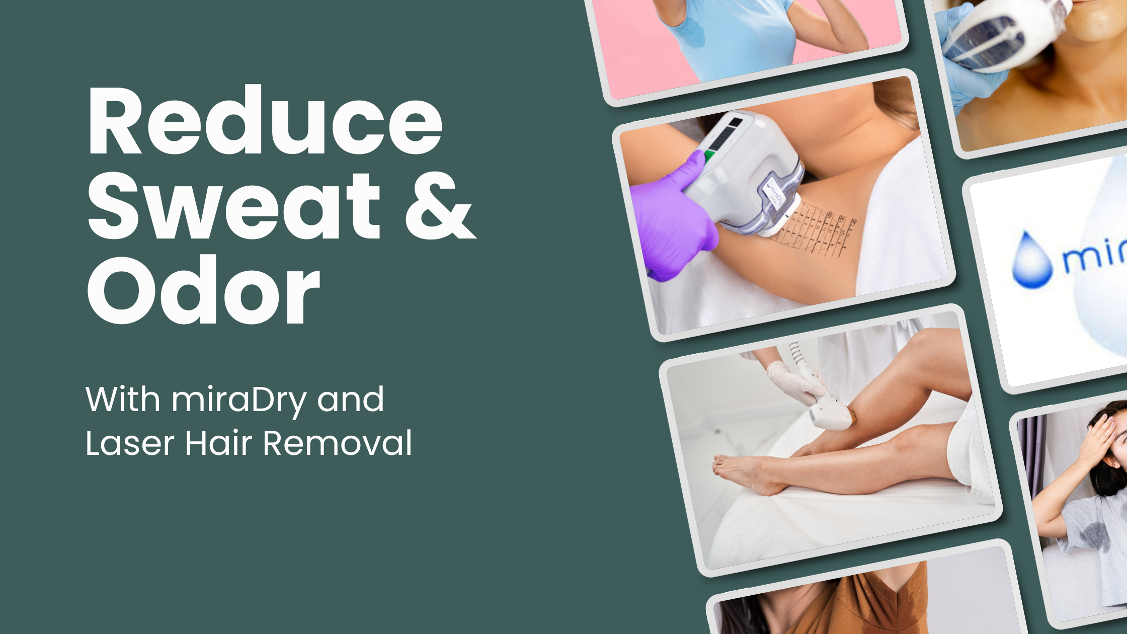 How to Reduce Sweat & Odor with miraDry and Laser Hair Removal