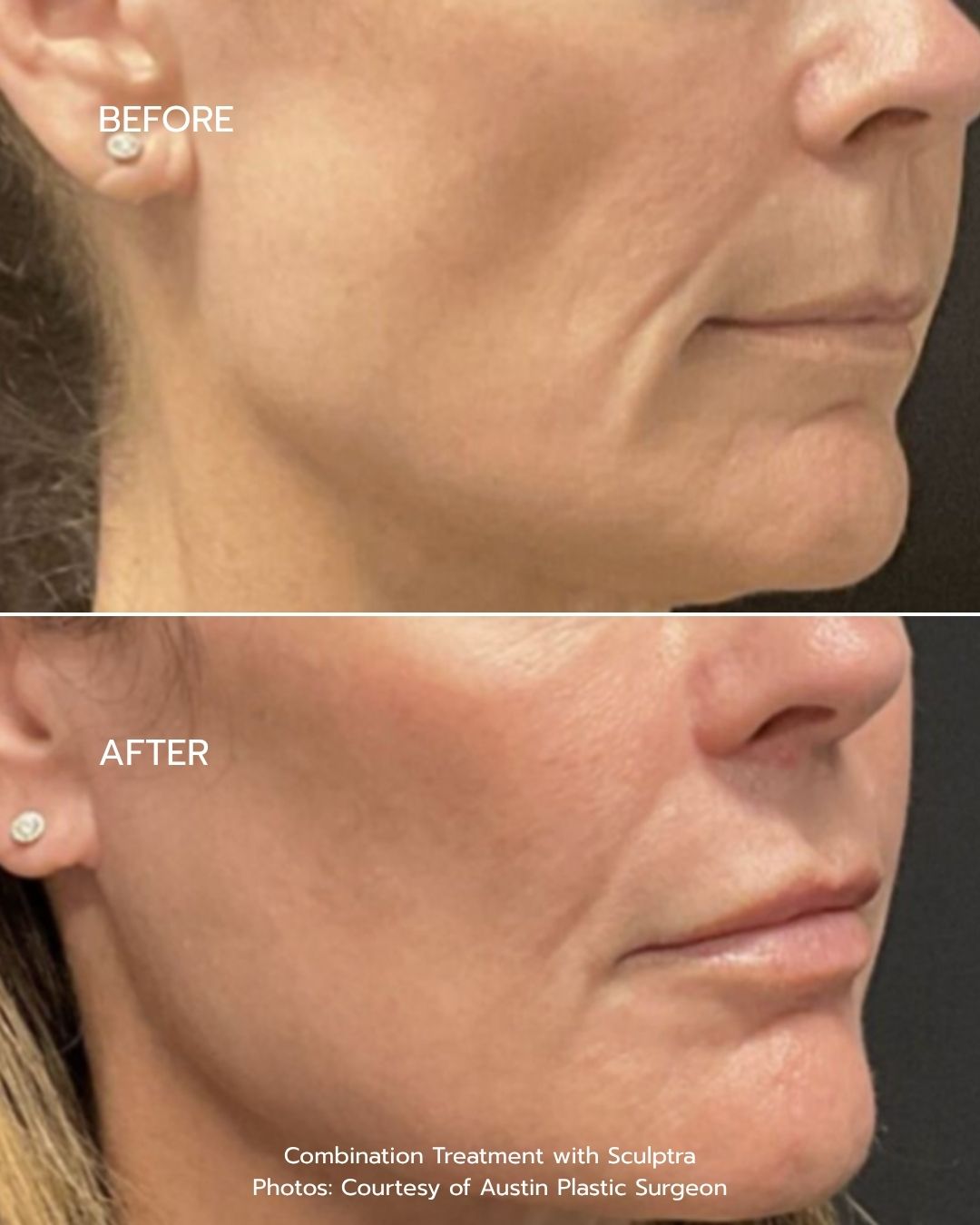 B&A - Option 1