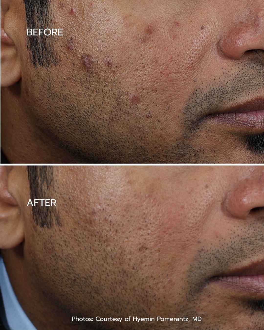 B&A - Option 10