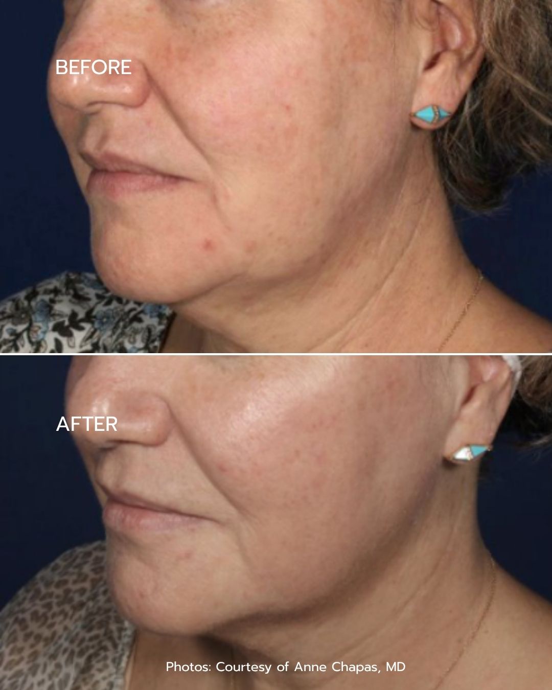 B&A - Option 2