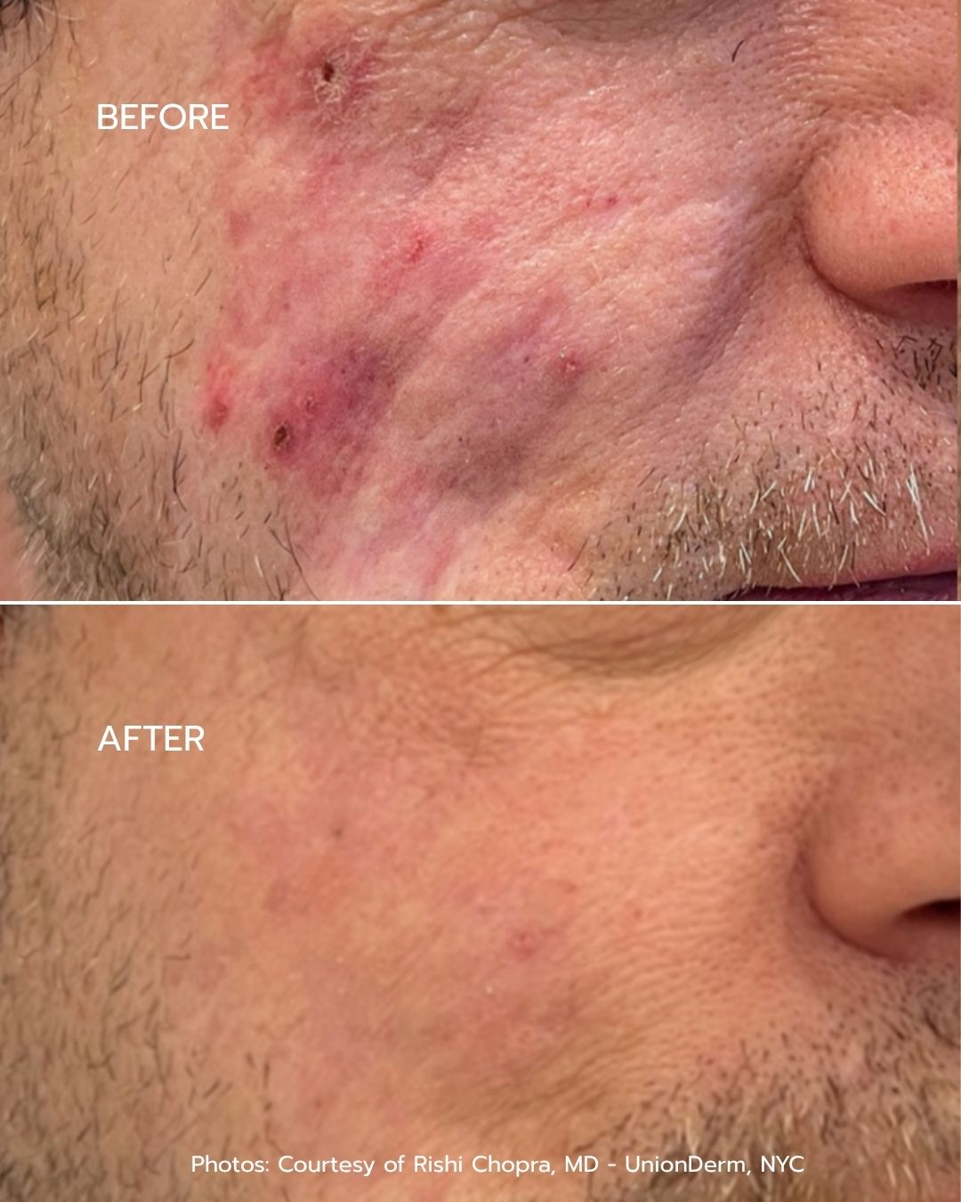 B&A - Option 3