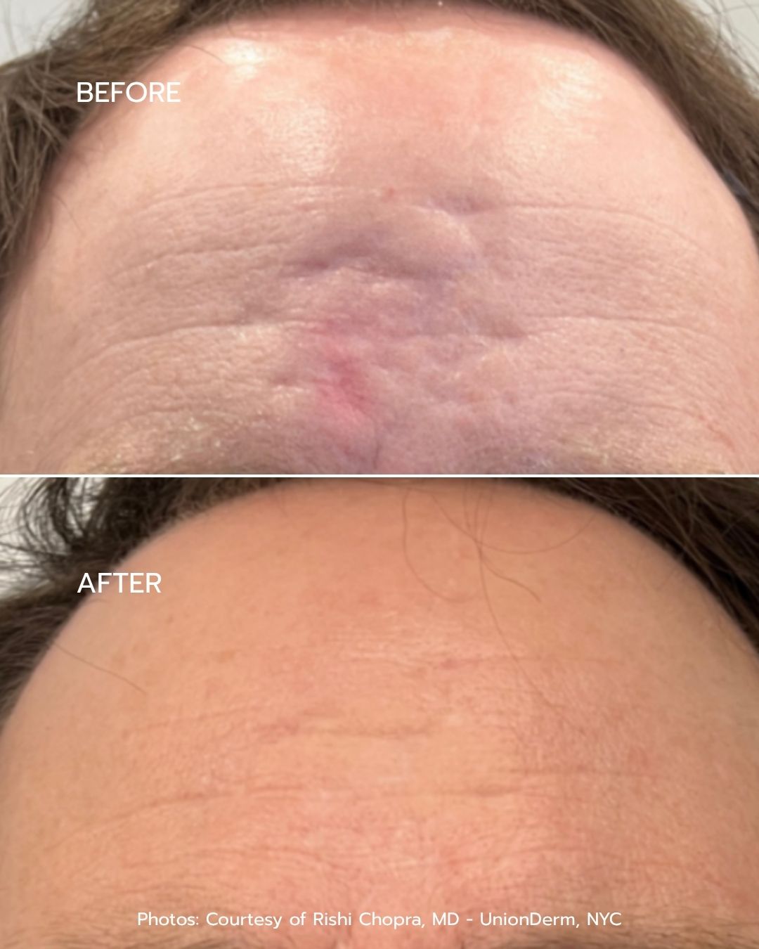 B&A - Option 4