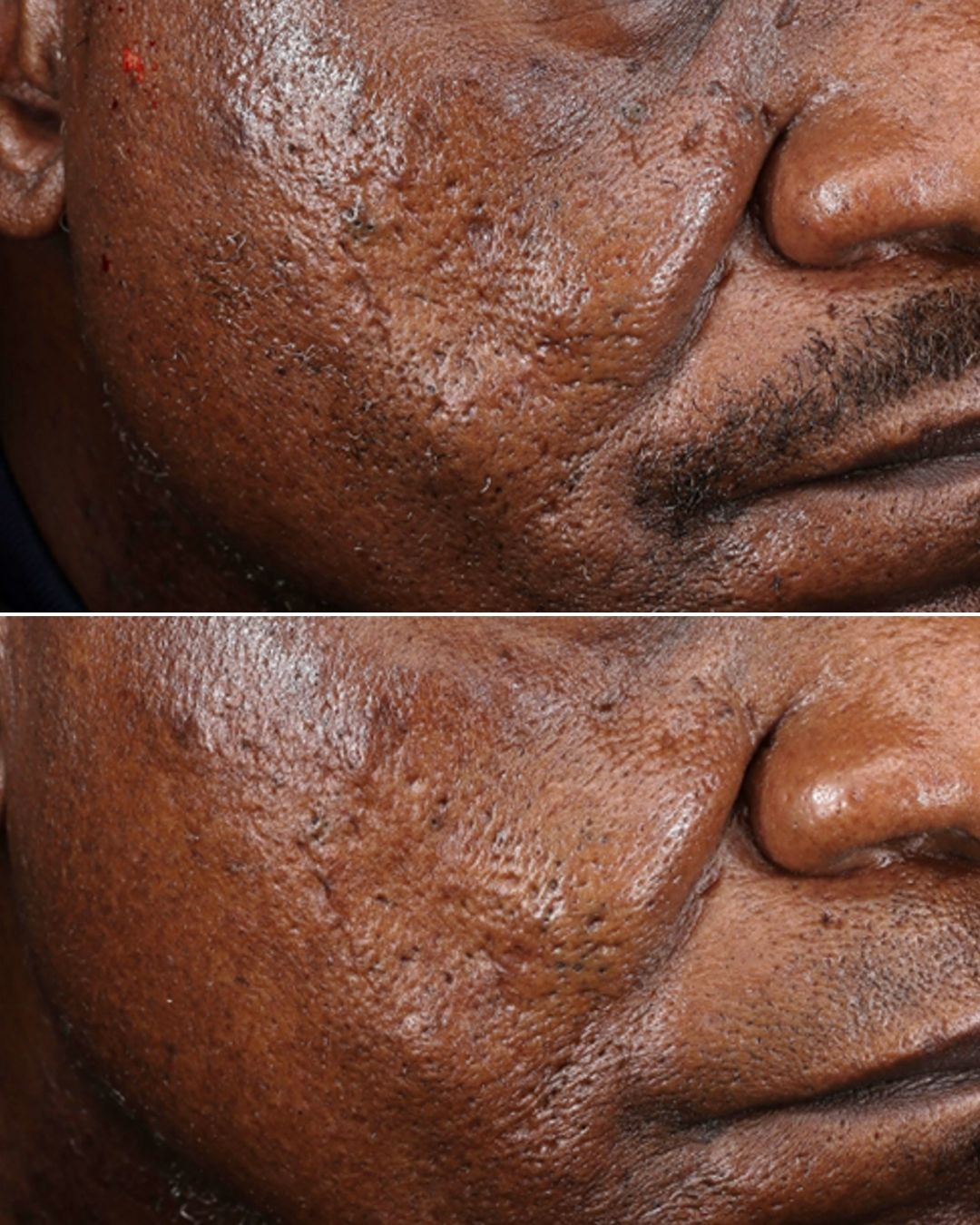B&A - Option 7