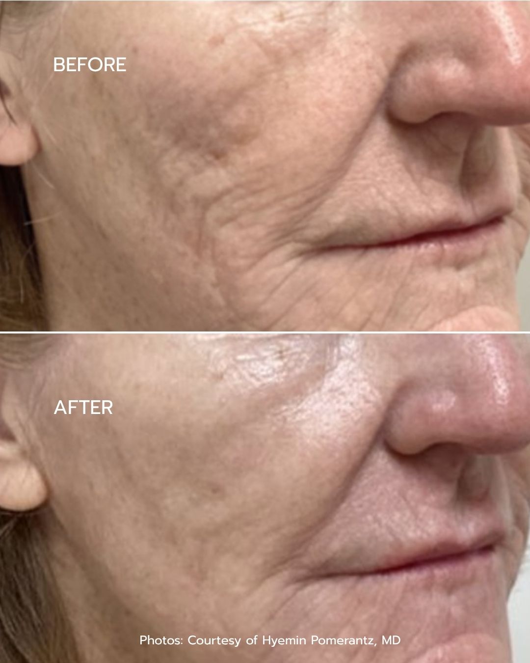 B&A - Option 8