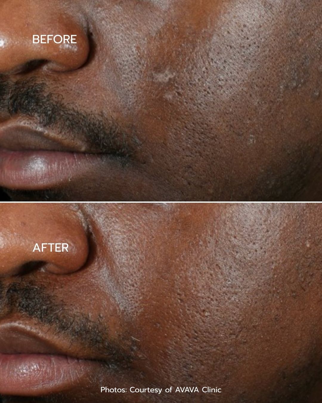 B&A - Option 9
